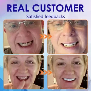 HEATWOLF® 🦷Premium Advanced Customized Full Denture Set 💎