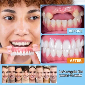 HEATWOLF® 🦷Premium Advanced Customized Full Denture Set 💎