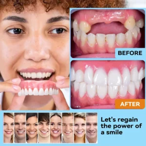 Minceetbien™ Silicone Reline Denture Set