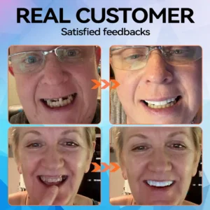 Minceetbien™ Silicone Reline Denture Set