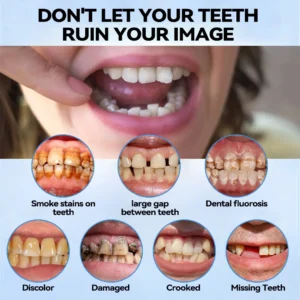 Minceetbien™ Silicone Reline Denture Set