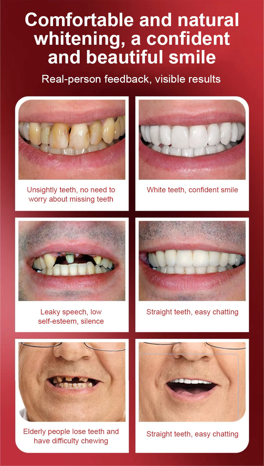 Minceetbien™ Silicone Reline Denture Set