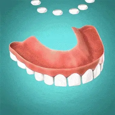 Minceetbien™ Silicone Reline Denture Set