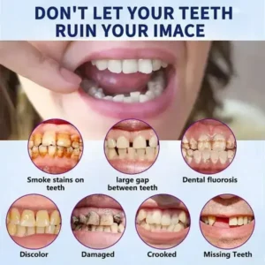 NESLEMY™ Advanced Customized Full Denture Set