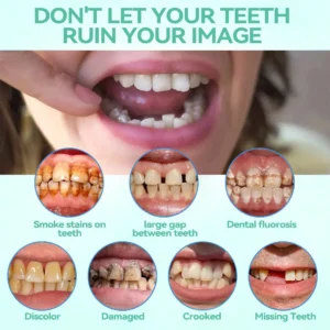 𝐁𝐢𝐤𝐞𝐧𝐝𝐚®🌍𝐏𝐫𝐞𝐦𝐢𝐮𝐦 𝐅𝐮𝐥𝐥 𝐒𝐞𝐭 𝐃𝐞𝐧𝐭𝐮𝐫𝐞𝐬 – 𝐍𝐚𝐭𝐮𝐫𝐚𝐥 𝐂𝐨𝐦𝐟𝐨𝐫𝐭, 𝐔𝐧𝐛𝐞𝐚𝐭𝐚𝐛𝐥𝐞 𝐅𝐢𝐭(🦷𝐋𝐢𝐦𝐢𝐭𝐞𝐝 𝐭𝐢𝐦𝐞 𝐝𝐢𝐬𝐜𝐨𝐮𝐧𝐭 𝐋𝐚𝐬𝐭 𝟑𝟎 𝐦𝐢𝐧𝐮𝐭𝐞𝐬🦷)