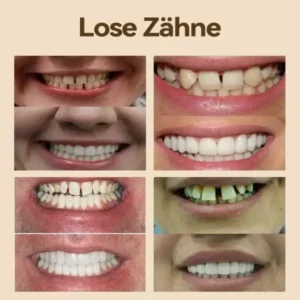𝐇𝐢𝐝𝐨𝐧𝐞® 🎀 𝐏𝐫𝐞𝐦𝐢𝐮𝐦 𝐆𝐞𝐛𝐢𝐬𝐬- (👩‍🔬𝑀𝐷𝑅-𝐾𝑜𝑛𝑓𝑜𝑟𝑚 𝑉𝑜𝑛 𝑃𝑟𝑜𝑓𝑒𝑠𝑠𝑖𝑜𝑛𝑒𝑙𝑙𝑒𝑛 𝑍𝑎ℎ𝑛ä𝑟𝑧𝑡𝑒𝑛 𝐺𝑒𝑛𝑒ℎ𝑚𝑖𝑔𝑡