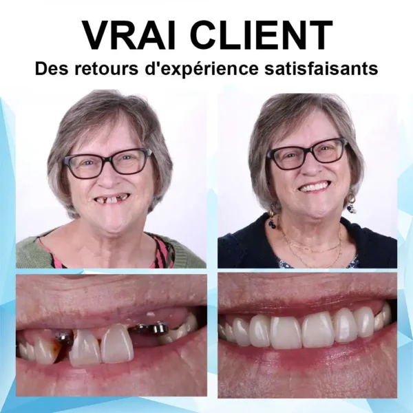 𝐁𝐢𝐤𝐞𝐧𝐝𝐚™ 🌸𝐊𝐢𝐭 𝐝𝐞 𝐑𝐞𝐛𝐚𝐬𝐚𝐠𝐞 𝐞𝐧 𝐒𝐢𝐥𝐢𝐜𝐨𝐧𝐞 𝐩𝐨𝐮𝐫 𝐏𝐫𝐨𝐭𝐡è𝐬𝐞𝐬(⏰𝐋𝐚 𝐫é𝐝𝐮𝐜𝐭𝐢𝐨𝐧 𝐥𝐢𝐦𝐢𝐭é𝐞 𝐝𝐚𝐧𝐬 𝐥𝐞 𝐭𝐞𝐦𝐩𝐬 𝐝𝐮𝐫𝐞 𝟑𝟎 𝐦𝐢𝐧𝐮𝐭𝐞𝐬⏰）