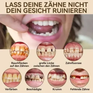 𝐇𝐢𝐝𝐨𝐧𝐞®🚀 – 🦷𝐏𝐫𝐞𝐦𝐢𝐮𝐦 𝐆𝐞𝐛𝐢𝐬𝐬🦷（✨Geeignet für alle Mundformen, speziell angefertigte Zahnersätze für die perfekte Passform✨）