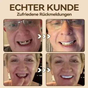 𝐇𝐢𝐝𝐨𝐧𝐞®🚀 – 🦷𝐏𝐫𝐞𝐦𝐢𝐮𝐦 𝐆𝐞𝐛𝐢𝐬𝐬🦷（✨Geeignet für alle Mundformen, speziell angefertigte Zahnersätze für die perfekte Passform✨）