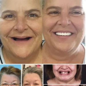 𝐇𝐢𝐝𝐨𝐧𝐞® 🦷Advanced Customized Full Denture Set🦷 (🔥10,000+ Sold In Last 30 Day)
