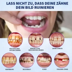 NESLEMY™-🦷 Fortgeschrittenes, maßgeschneidertes Vollprothesen-Set 🦷 (⏰ Limitierter Rabatt, nur noch 30 Minuten verfügbar ⏰)