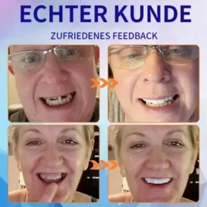 NESLEMY™-🦷 Fortgeschrittenes, maßgeschneidertes Vollprothesen-Set 🦷 (⏰ Limitierter Rabatt, nur noch 30 Minuten verfügbar ⏰)