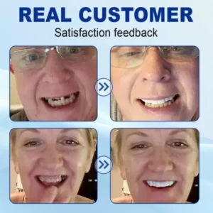 Nurbini® Advanced Customized Full Denture Set