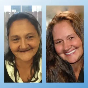 𝗠𝗲𝗱𝗶𝗰𝗮𝗹-𝗚𝗿𝗮𝗱𝗲 𝗙𝘂𝗻𝗰𝘁𝗶𝗼𝗻𝗮𝗹 𝗧𝗵𝗶𝗰𝗸𝗲𝗻𝗲𝗱 𝗗𝗲𝗻𝘁𝘂𝗿𝗲𝘀🗽𝗠𝗮𝗱𝗲 𝗜𝗻 𝗧𝗵𝗲 𝗨𝗦𝗔