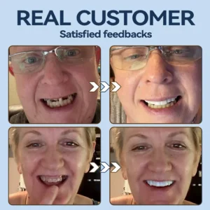 Bikenda® 👧🏻🔆- 𝐏𝐫𝐞𝐦𝐢𝐮𝐦 𝐃𝐞𝐧𝐭𝐮𝐫𝐞- (✨Suitable for all mouth shapes, custom-made dentures for a perfect fit✨）