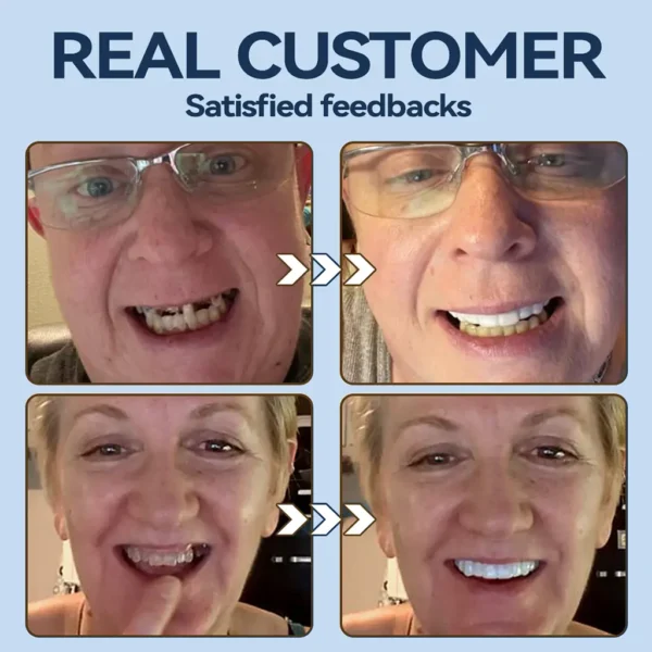 Bikenda® 👧🏻🔆- 𝐏𝐫𝐞𝐦𝐢𝐮𝐦 𝐃𝐞𝐧𝐭𝐮𝐫𝐞- (✨Suitable for all mouth shapes, custom-made dentures for a perfect fit✨）