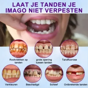 HEATWOLF™ Geavanceerde op maat gemaakte volledige protheseset🌸(Officieel aanbevolen product door de Belgische Tandartsenvereniging (BDA))🎁