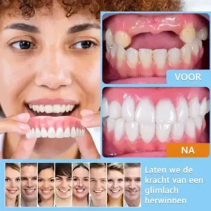 HEATWOLF™ Geavanceerde op maat gemaakte volledige protheseset🌸(Officieel aanbevolen product door de Belgische Tandartsenvereniging (BDA))🎁