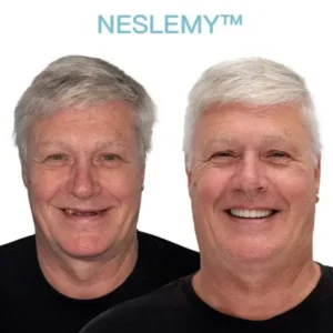 NESLEMY™ GelFit Dentures – Made in the USA & FDA-Certified