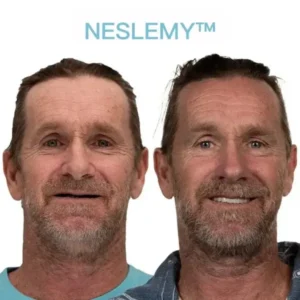 NESLEMY™ GelFit Dentures – Made in the USA & FDA-Certified