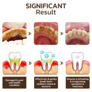 SmileFitPro™ Niacinamide Whitening Toothpaste