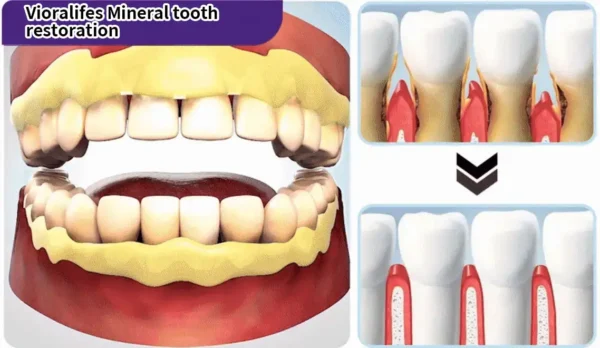 Vioralifes™ Teeth Restoration Mineral Powder