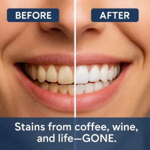 🏆 Newyuo® Nicotinamide Toothpaste💎New upgrade Powerful type 10% concentration of Nicotinamide