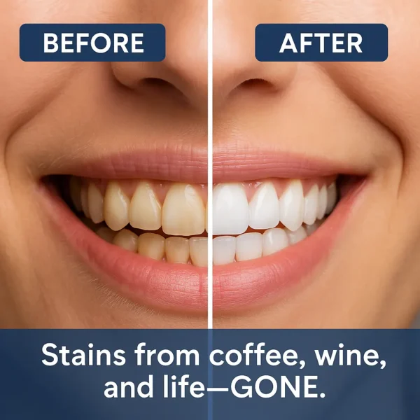 🏆 Newyuo® Nicotinamide Toothpaste💎New upgrade Powerful type 10% concentration of Nicotinamide
