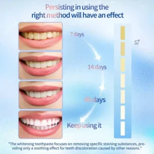 LOVILDS™ Niacinamide Whitening Toothpaste (Imported From USA)