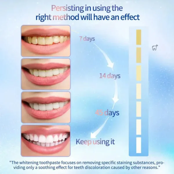 LOVILDS™ Niacinamide Whitening Toothpaste (Imported From USA)