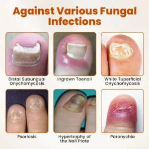 Timilk® BeeGuard Antifungal Drops