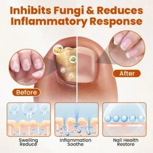 Timilk® BeeGuard Antifungal Drops