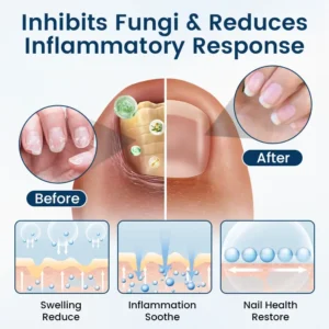 Timilk® OnyxiGuard Fungal Repair Herbal Spray