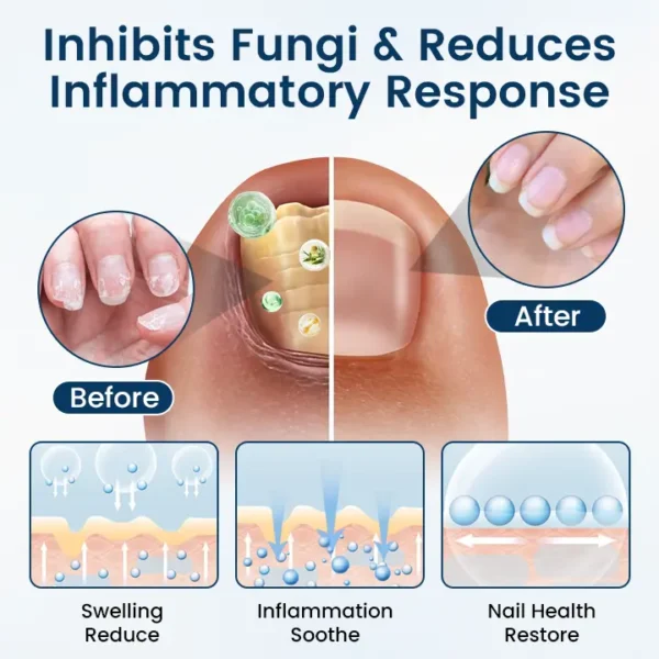 Timilk® OnyxiGuard Fungal Repair Herbal Spray