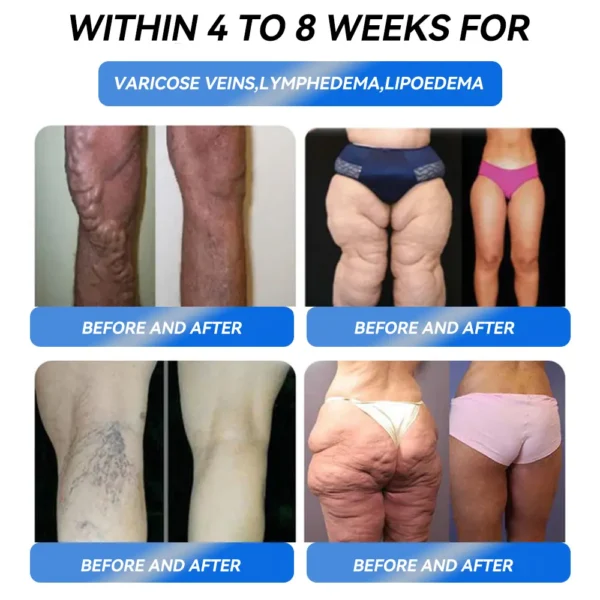 WarmFamily® GLP-1 Pro Weight Loss Oral Solution7 days visible effect, no side effects, suitable for all age groups 🌸