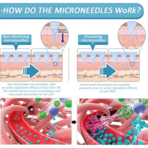 WarmFamily® SMGT-GLP-1 Nano Microneedle Patch with Collagen & Matrixyl 3000 ✅ | Clinically Proven for Weight Loss, Cardiovascular Health, Diabetes, and More Health Issues, Doctor Recommended👨‍⚕️