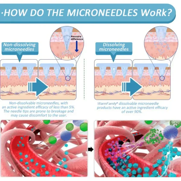 WarmFamily® SMGT-GLP-1 Nano Microneedle Patch with Collagen & Matrixyl 3000 ✅ | Clinically Proven for Weight Loss, Cardiovascular Health, Diabetes, and More Health Issues, Doctor Recommended👨‍⚕️