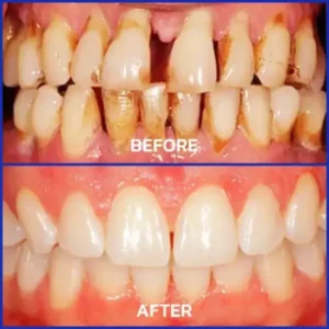 Rolimey® VioCore Bee Venom Dental Treatment Toothpaste
