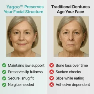 Yagoo™ Custom Custom-Fit Full Functional Dentures