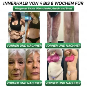 𝐊𝐞𝐲𝐞𝐬𝐬® GLP-1 & Matrixyl 3000 Schlankheits- & Gesundheits-Tropfen