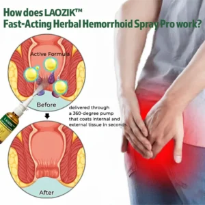 LAOZIK™ Fast-Acting Herbal Hemorrhoid Spray Pro