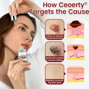 Ceoerty® KeraErase Black Rice Renewal Ampoule