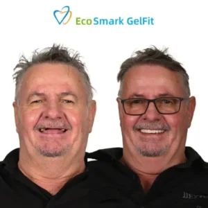 EcoSmark GelFit Dentures