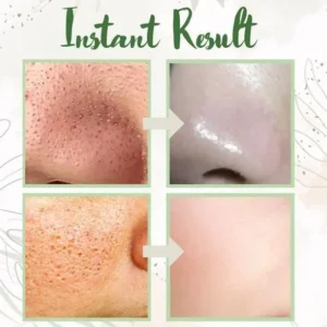 LOVILDS Green Tea Deep Cleanse Mask