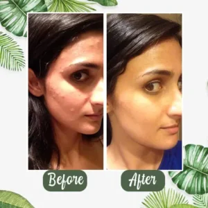 LOVILDS Green Tea Deep Cleanse Mask