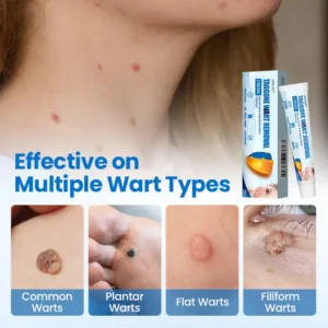 LOVILDS™ TagGone Wart Removal Cream