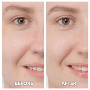 DermaLift 5-in-1 Facial Sculptor & Cleanser Device