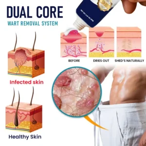 Cvreoz® Genital Warts Remover Cream