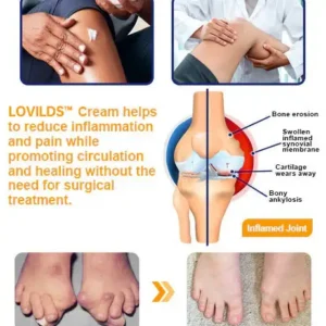 LOVILDS™ Bee Poison Advanced Joint and Bone Healing Cream