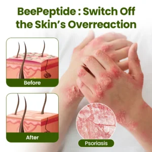 NESLEMY® BeePeptide RootSoft DualRelief Cream